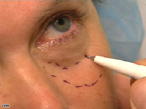 plastic surgery